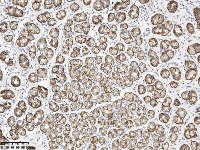 Immunohistochemistry-Paraffin: Claudin-18 Antibody (179) [NBP3-14643] - Staining of Claudin-18 in human stomach with rabbit monoclonal antibody at 1:10000 dilution. 