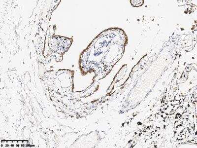 Immunohistochemistry-Paraffin: Claudin-18 Antibody (179) [NBP3-14643] - Staining of Claudin-18 in human lung with rabbit monoclonal antibody at 1:10000 dilution. 
