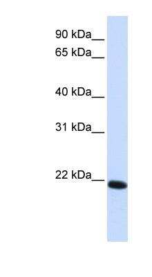 Western Blot: Claudin-19 Antibody [NBP1-59277] -  Transfected 293T cell lysate, concentration 0.2-1 ug/ml.