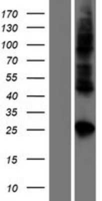 Western Blot: Claudin 19 Overexpression Lysate (Adult Normal) [NBP2-05422] Left-Empty vector transfected control cell lysate (HEK293 cell lysate); Right -Over-expression Lysate for Claudin 19.