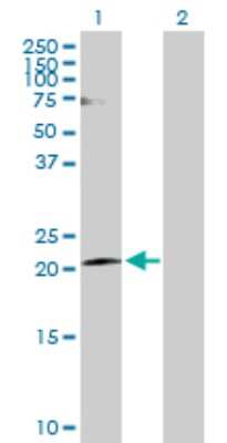 Western Blot: Claudin-20 Antibody [H00049861-D01P] - Analysis of CLDN20 expression in transfected 293T cell line by CLDN20 polyclonal antibody.Lane 1: CLDN20 transfected lysate(23.50 KDa).Lane 2: Non-transfected lysate.
