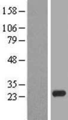 Western Blot: Claudin 20 Overexpression Lysate (Adult Normal) [NBL1-09244] Left-Empty vector transfected control cell lysate (HEK293 cell lysate); Right -Over-expression Lysate for Claudin 20.