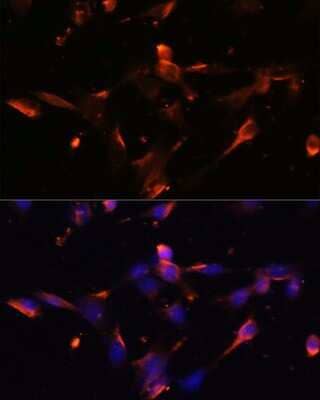 Immunocytochemistry/ Immunofluorescence Claudin-5 Antibody - Azide and BSA Free