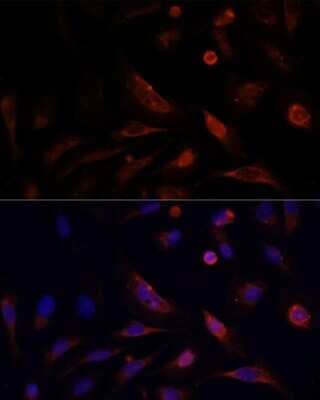 Immunocytochemistry/ Immunofluorescence Claudin-5 Antibody - Azide and BSA Free