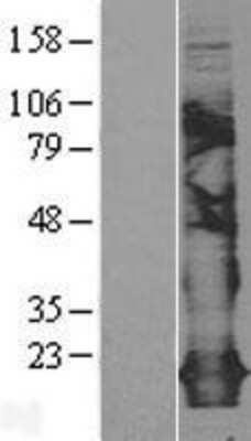 Western Blot: Claudin 5 Overexpression Lysate (Adult Normal) [NBL1-09247] Left-Empty vector transfected control cell lysate (HEK293 cell lysate); Right -Over-expression Lysate for Claudin 5.