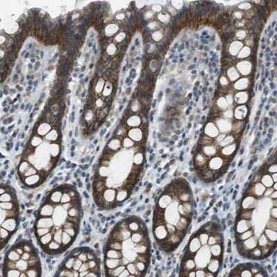 Immunohistochemistry-Paraffin: Claudin-7 Antibody [NBP1-85683] - Staining of human rectum shows high expression.