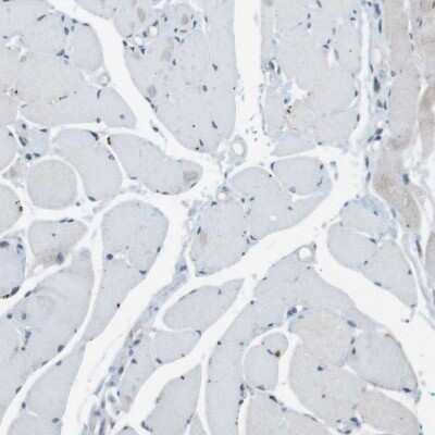 <b>Orthogonal Strategies Validation. </b>Immunohistochemistry-Paraffin: Claudin-7 Antibody [NBP1-85683] - Staining of human skeletal muscle shows low expression as expected.