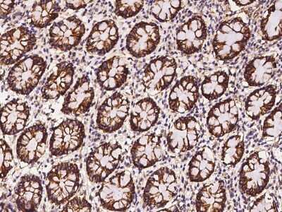 Immunohistochemistry-Paraffin: Claudin-7 Antibody [NBP2-97417] - Staining of human Claudin-7 in human rectum with rabbit polyclonal antibody at 1:100 dilution.