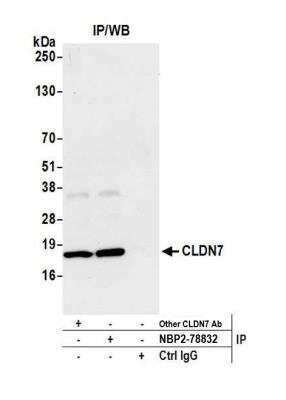 Immunoprecipitation: Claudin-7 Antibody [NBP2-78833] - Detection of human CLDN7 by western blot of immunoprecipitates. Samples: Whole cell lysate (1.0 mg per IP reaction; 20% of IP loaded) from MCF-7 cells prepared using NETN lysis buffer. Antibodies: Affinity purified rabbit anti-CLDN7 antibody NBP2-78833 used for IP at 40 ul per reaction. CLDN7 was also immunoprecipitated by another rabbit anti-CLDN7 antibody. For blotting immunoprecipitated CLDN7, NBP2-78833 was used at 1:1000. Detection: Chemiluminescence with an exposure time of 10 seconds.