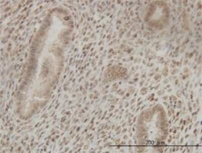 Immunohistochemistry-Paraffin: Cleavage stimulation factor 2 Antibody (3D1-3A6) [H00001478-M01] - Analysis of monoclonal antibody to CSTF2 on formalin-fixed paraffin-embedded human endometrium tissue. Antibody concentration 3 ug/ml.