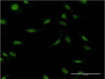 Immunocytochemistry/Immunofluorescence: Cleavage stimulation factor 2 Antibody (4E3-3C9) [H00001478-M02] - Analysis of monoclonal antibody to CSTF2 on HeLa cell . Antibody concentration 10 ug/ml.