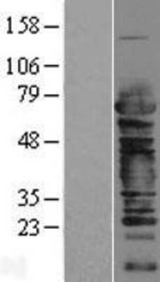 Western Blot Cleavage stimulation factor 2 Overexpression Lysate