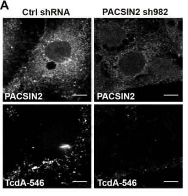 Immunocytochemistry/Immunofluorescence: Clostridium Difficile Toxin A Antibody (PCG4.1) [NB600-1066] - Depletion of PACSIN2 inhibits TcdA entry in Caco-2 cells. Caco-2 cells expressing non-targeting shRNA (Ctrl shRNA) or shRNA 982 targeting PACSIN2 were incubated with 50 nM TcdA-546 at 10C for 45 min. Unbound toxins were removed and cells were shifted to 37C to allow internalization. After 20 min, cells were washed, fixed, stained for PACSIN2 and imaged by confocal microscopy. PACSIN2 and TcdA staining from ctrl shRNA and sh982 expressing cells are shown. The images shown are representative of multiple fields imaged from three independent experiments. Image collected and cropped by CiteAb from the following publication (//dx.plos.org/10.1371/journal.ppat.1006070), licensed under a CC-BY license.