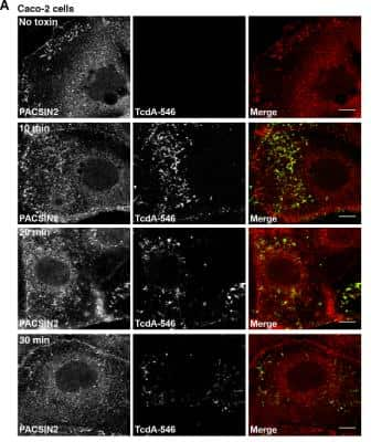 Immunocytochemistry/Immunofluorescence: Clostridium Difficile Toxin A Antibody (PCG4.1) [NB600-1066] - TcdA colocalizes with PACSIN2 during entry in Caco-2 cells. Immunofluorescence assays were performed as described in Fig 1B. At indicated time points, cells were fixed, stained for PACSIN2 and analyzed by confocal microscopy. Merged images show PACSIN2 in red, toxin in green and colocalization in yellow. The images shown are representative of multiple fields imaged from three independent experiments. Image collected and cropped by CiteAb from the following publication (//dx.plos.org/10.1371/journal.ppat.1006070), licensed under a CC-BY license.