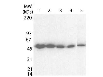 Western Blot: Clostridium Tetani Toxoid Antibody [NBP1-78003] - Detection of a protein band at ~ 52 kDa corresponding to full length 6XHIS-TTFC fusion protein (arrowhead). Lanes 1-5 contain 10 ng, 5ng 2.5ng, 1.25 ng and 0.0625 ng protein respectively. MW markers are shown at the left for size comparison. After blocking, the membrane was probed with the primary antibody diluted to 1:100,000 followed by reaction with a 1:20,000 dilution of HRP conjugated donkey-anti-Rabbit IgG [H&L].