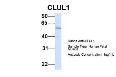 Western Blot: Clusterin-like 1/CLUL1 Antibody [NBP1-57712] - Human Fetal Muscle, Antibody Dilution: 1.0 ug/ml.