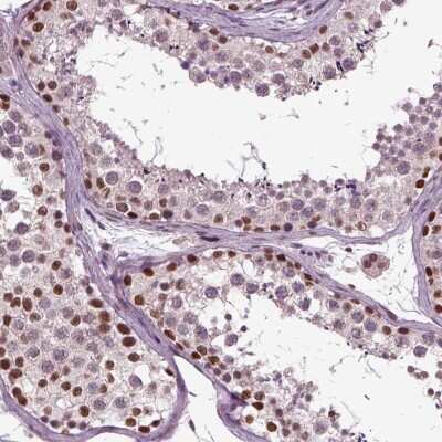 Immunohistochemistry CoREST3/RCOR3 Antibody - BSA Free