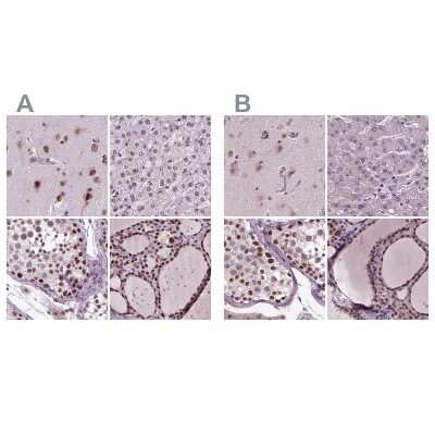 Immunohistochemistry-Paraffin CoREST3/RCOR3 Antibody - BSA Free