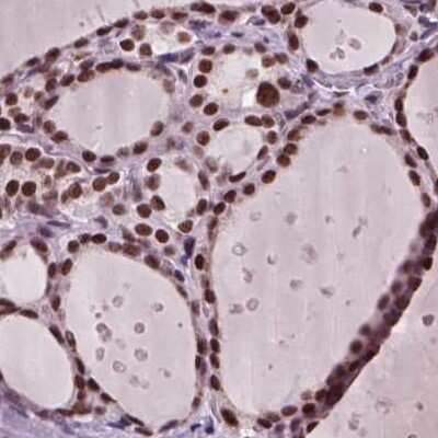 Immunohistochemistry-Paraffin CoREST3/RCOR3 Antibody - BSA Free