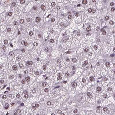 Immunohistochemistry-Paraffin CoREST3/RCOR3 Antibody - BSA Free