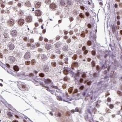 Immunohistochemistry-Paraffin CoREST3/RCOR3 Antibody - BSA Free