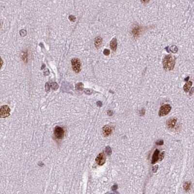 Immunohistochemistry-Paraffin CoREST3/RCOR3 Antibody - BSA Free