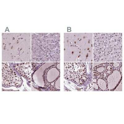 Immunohistochemistry-Paraffin CoREST3/RCOR3 Antibody - BSA Free