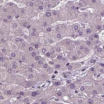 Immunohistochemistry-Paraffin CoREST3/RCOR3 Antibody - BSA Free