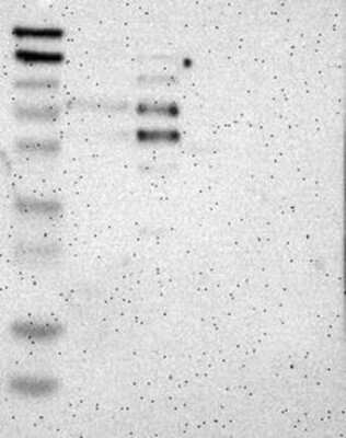 Western Blot: CoREST3/RCOR3 Antibody [NBP3-17822] - Lane 1: Marker [kDa] 230, 130, 95, 72, 56, 36, 28, 17, 11;   Lane 2: RT4;   Lane 3: U-251 MG;   Lane 4: Human Plasma;   Lane 5: Liver;   Lane 6: Tonsil
