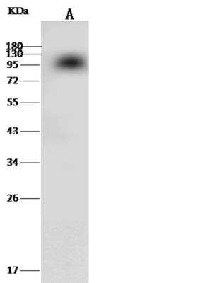 Western Blot: Coagulation Factor II/Thrombin Antibody (318) [NBP2-90543] - Lane A: Mouse kidney tissue lysateLysates/proteins at 30 ug per lane.SecondaryGoat Anti-Rabbit IgG (H+L)/HRP at 1/10000 dilution.Developed using the ECL technique.Performed under reducing conditions.Predicted band size:70 kDaObserved band size:90 kDa