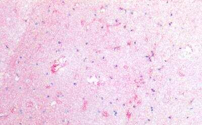 Immunohistochemistry-Paraffin: Coagulation Factor III/Tissue Factor Antibody (HTF-1) [NBP2-62199] -  Staining of human cortex (paraffin-embedded sections) with anti-CD142 (HTF-1), 10 ug/ml.