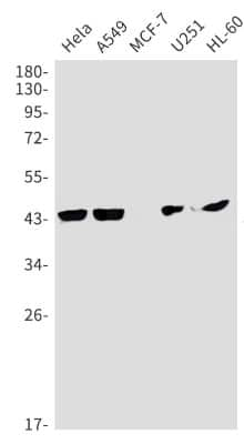 Western Blot: Coagulation Factor III/Tissue Factor Antibody (S04-7G2) [NBP3-14883] - Western blot detection of Coagulation Factor III/Tissue Factor in Hela, A549, MCF-7, U251, HL-60 cell lysates using Coagulation Factor III/Tissue Factor Rabbit mAb (1:1000 diluted). Predicted band size: 33kDa. Observed band size: 45kDa.