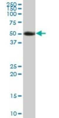 Western Blot: Coagulation Factor III/Tissue Factor Antibody [H00002152-B01P] - Analysis of F3 expression in human pancreas.