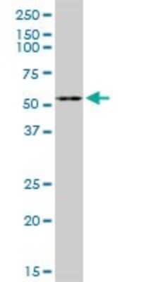 Western Blot: Coagulation Factor VII Antibody [H00002155-D01P] - Analysis of F7 expression in A-431.