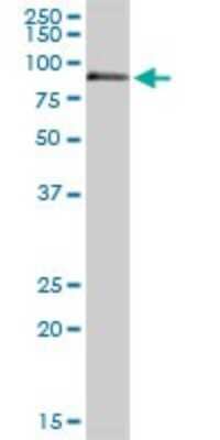 Western Blot: Coagulation Factor XI Antibody [H00002160-D01P] - Analysis of F11 expression in human liver.