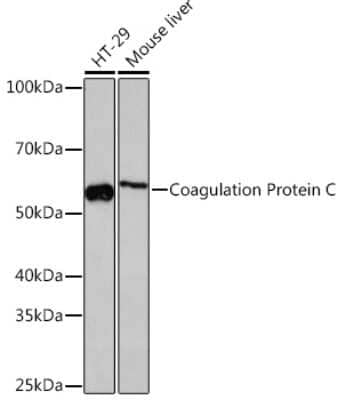 Western Blot: Coagulation Factor XIV/Protein C Antibody (3W3R7) [NBP3-16427] - Western blot analysis of extracts of various cell lines, using Coagulation Coagulation Factor XIV/Protein C Rabbit mAb (NBP3-16427) at 1:1000 dilution. Secondary antibody: HRP Goat Anti-Rabbit IgG (H+L) at 1:10000 dilution. Lysates/proteins: 25ug per lane. Blocking buffer: 3% nonfat dry milk in TBST. Detection: ECL Basic Kit. Exposure time: 3min.