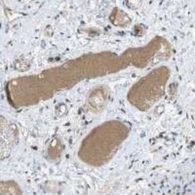 Immunohistochemistry-Paraffin: Coagulation Factor XIV/Protein C Antibody (6B2) - BSA Free [NBP1-05151] - Human colon stained with NBP1-05151 (www.proteinatlas.org)