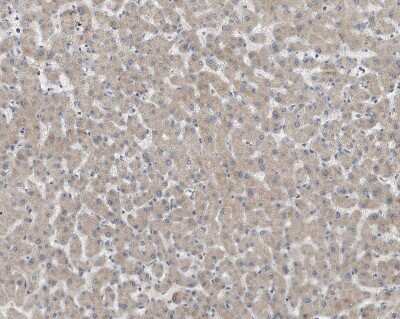 Immunohistochemistry-Paraffin: Coagulation Factor XIV/Protein C Antibody (6B2) - BSA Free [NBP1-05151] - Human colon stained with NBP1-05151 (www.proteinatlas.org)
