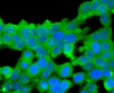 Immunocytochemistry/Immunofluorescence: Coagulation Factor XIV/Protein C Antibody (JM93-61) [NBP2-66987] - Staining Protein C in 293T cells (green). The nuclear counter stain is DAPI (blue). Cells were fixed in paraformaldehyde, permeabilised with 0.25% Triton X100/PBS.