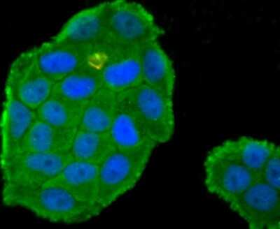 Immunocytochemistry/Immunofluorescence: Coagulation Factor XIV/Protein C Antibody (JM93-61) [NBP2-66987] - Staining Protein C in Hela cells (green). The nuclear counter stain is DAPI (blue). Cells were fixed in paraformaldehyde, permeabilised with 0.25% Triton X100/PBS.