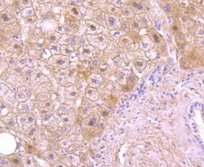 Immunohistochemistry-Paraffin: Coagulation Factor XIV/Protein C Antibody (JM93-61) [NBP2-66987] - Analysis of paraffin-embedded human liver tissue using anti-Protein C antibody. Counter stained with hematoxylin.