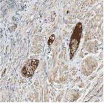 ELISA: Coagulation Factor XIV/Protein C Antibody (PC 7) - BSA Free [NBP1-05113] - Human fallopian tube stained with Coagulation Factor XIV/Protein C Antibody.