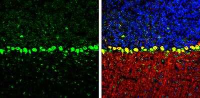 Immunohistochemistry-Frozen: Coatomer Subunit Delta Antibody (1318) [NBP2-43608] - Coatomer Subunit Delta Antibody (1318) detects Coatomer Subunit Delta protein by immunohistochemical analysis. Sample: Frozen-sectioned mouse mouse cerebellum. Green: Coatomer Subunit Delta stained by Coatomer Subunit Delta Antibody (1318) diluted at 1:250. Red: Calbindin, stained by Calbindin antibody diluted at 1:500. Blue: Fluoroshield with DAPI. Antigen Retrieval: Citrate buffer, pH 6.0, 10 min.