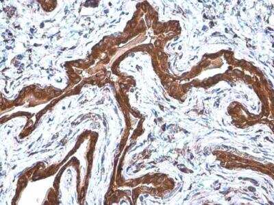 Immunohistochemistry-Paraffin: Coatomer Subunit Delta Antibody (1318) [NBP2-43608] - Coatomer Subunit Delta Antibody (1318) detects Coatomer Subunit Delta protein at cytoplasm by immunohistochemical analysis. Sample: Paraffin-embedded rat urinary bladder. Coatomer Subunit Delta stained by Coatomer Subunit Delta Antibody (1318) diluted at 1:200. Antigen Retrieval: Citrate buffer, pH 6.0, 15 min.