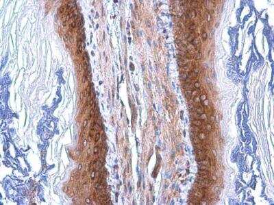 <b>Genetic Strategies Validation. </b>Immunohistochemistry-Paraffin: Coatomer Subunit Delta Antibody (1318) [NBP2-43608] - Coatomer Subunit Delta Antibody (1318) detects Coatomer Subunit Delta protein at cytoplasm by immunohistochemical analysis. Sample: Paraffin-embedded mouse esophagus. Coatomer Subunit Delta stained by Coatomer Subunit Delta Antibody (1318) diluted at 1:200. Antigen Retrieval: Citrate buffer, pH 6.0, 15 min.