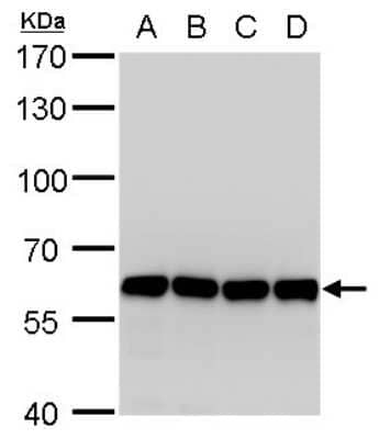 Western Blot: Coatomer Subunit Delta Antibody (1318) [NBP2-43608] - Analysis of A. 30 ug 293T whole cell lysate/extract B. 30 ug A431 whole cell lysate/extract C. 30 ug HeLa whole cell lysate/extract | D. 30 ug HepG2 whole cell lysate/extract 7.5 % SDS-PAGE COPD antibody [1318] dilution: 1:1000