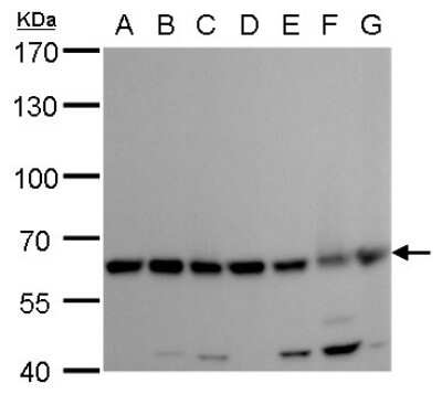 Western Blot: Coatomer Subunit Delta Antibody (1318) [NBP2-43608] - Analysis of A. 30 ug Neuro2A whole cell lysate/extract B. 30 ug GL261 whole cell lysate/extract C. 30 ug C8D30 whole cell lysate/extract D. 30 ug NIH-3T3 whole cell lysate/extract E. 30 ug BCL-1 whole cell lysate/extract F. 30 ug Raw 264.7 whole cell lysate/extract G. 30 ug C2Cl2 whole cell lysate/extract 7.5 % SDS-PAGE COPD antibody [1318] dilution: 1:1000