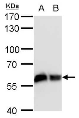 Western Blot: Coatomer Subunit Delta Antibody (1318) [NBP2-43608] - Analysis of A. 30 ug PC-12 whole cell lysate/extract B. 30 ug Rat2 whole cell lysate/extract 7.5 % SDS-PAGE COPD antibody [1318] dilution: 1:1000.