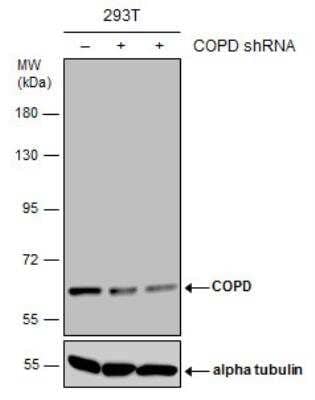 Western Blot: Coatomer Subunit Delta Antibody (1318) [NBP2-43608] - Non-transfected (-) and transfected (+) 293T whole cell extracts (30 ug) were separated by 7.5% SDS-PAGE, and the membrane was blotted with COPD antibody [1318].