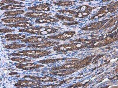 Immunohistochemistry-Paraffin: Coatomer Subunit Delta Antibody (189) [NBP2-43773] - Coatomer Subunit Delta Antibody (189) detects Coatomer Subunit Delta protein at cytoplasm by immunohistochemical analysis. Sample: Paraffin-embedded rat duodenum. Coatomer Subunit Delta stained by Coatomer Subunit Delta Antibody (189) diluted at 1:200. Antigen Retrieval: Citrate buffer, pH 6.0, 15 min.